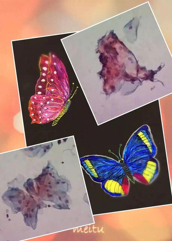 医艺相融！泰安市中心医院病理科侯巍巍深耕10年让病理切片成为会“讲故事”的画(图3)