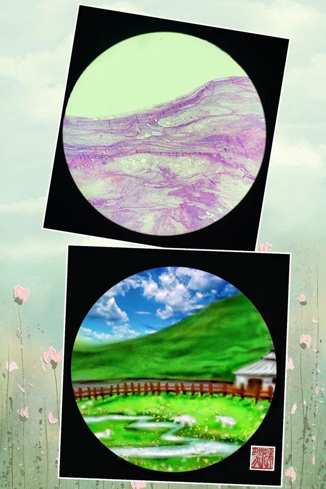 医艺相融！泰安市中心医院病理科侯巍巍深耕10年让病理切片成为会“讲故事”的画(图13)