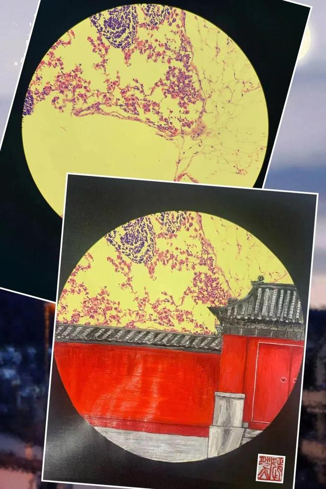 医艺相融！泰安市中心医院病理科侯巍巍深耕10年让病理切片成为会“讲故事”的画(图12)